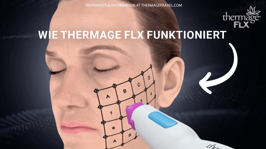 thermage-flx-explain-de