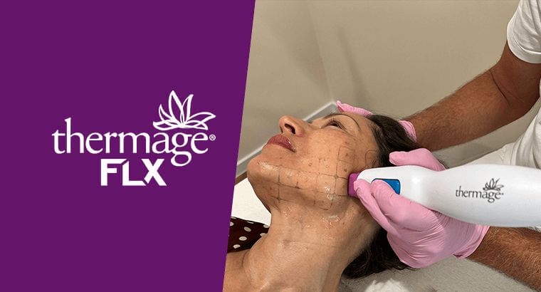 thermage-flx-beste-behandelingen
